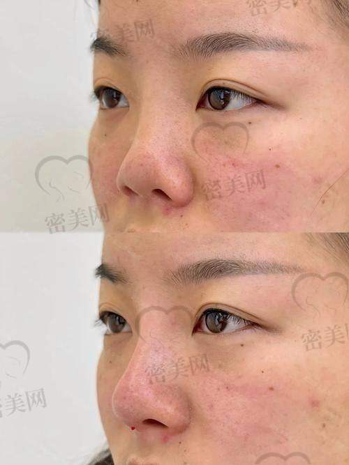 “美鼻精”的华丽变身