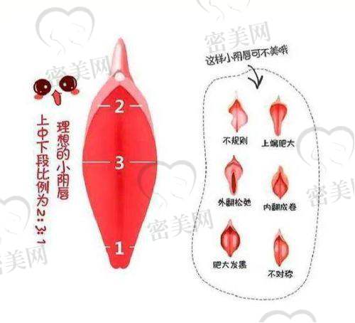上海伯思立葛敏女性私密整形：成效惊艳到爆