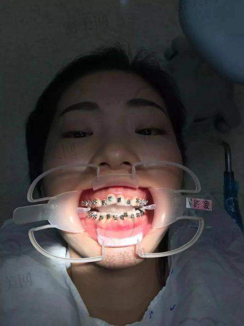 擅长项目