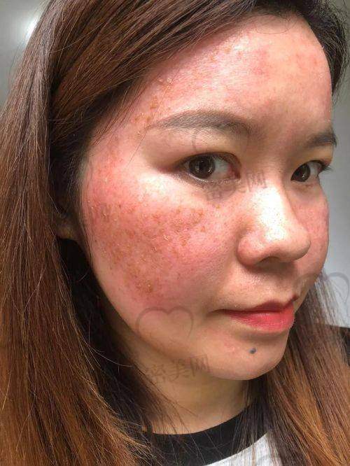 贵阳颜术医疗美容
