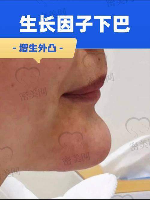 北京维恩长瀛医疗美容：动态摄影+实时取出系统