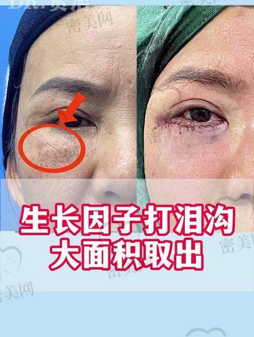 北京艾玛医疗美容：三维立体追踪术后平坦不凹陷