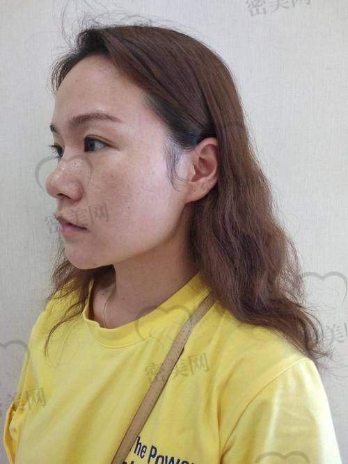 手术：紧张又期待的过程