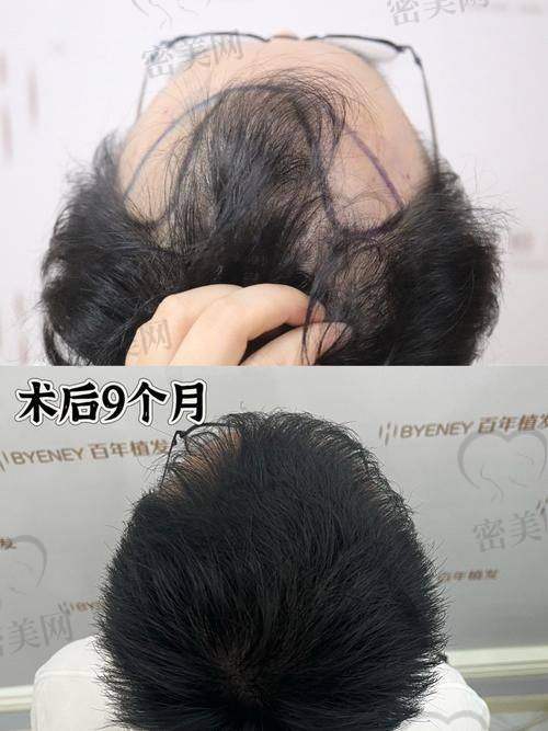 成都植发连锁机构（成都分院）