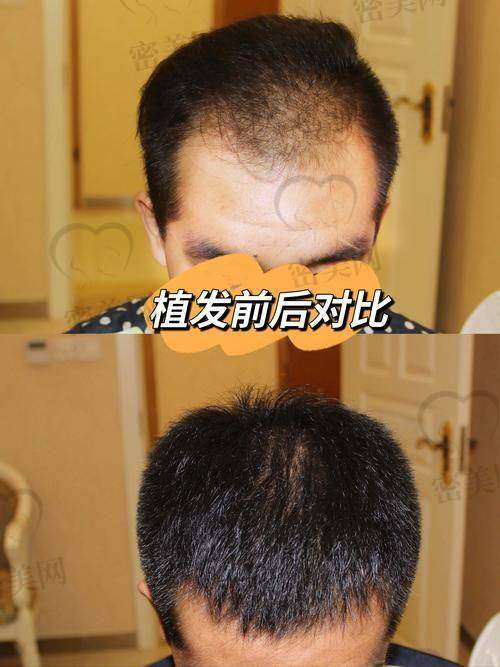 成都米兰柏羽医疗美容医院