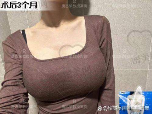 上海艺星整形彭才学：傲诺拉假体隆胸 5 - 10w 起，性价比之王