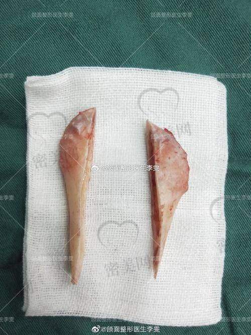 收费标准：性价比极高