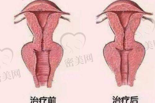 李瑞医生怎么预约挂号？