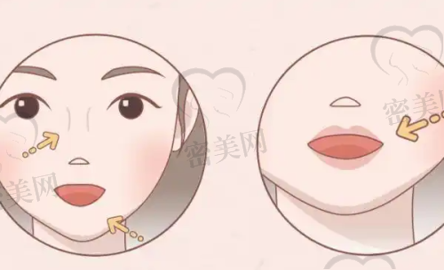 脸部填充选啥方法