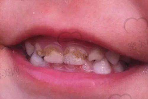 上海博厚宜嘉坊口腔门诊部口碑怎么样？