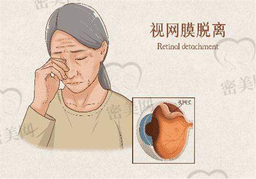 医生更重要！邢台眼科医院“摘镜天团”坐镇