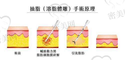 如何进行面诊与预约?