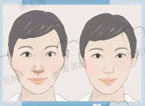 桂林181医院整形科——术后护理服务详细解读