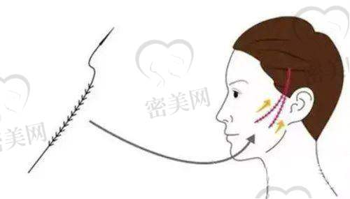 桂林181医院整形科——核心服务范畴详细讲解
