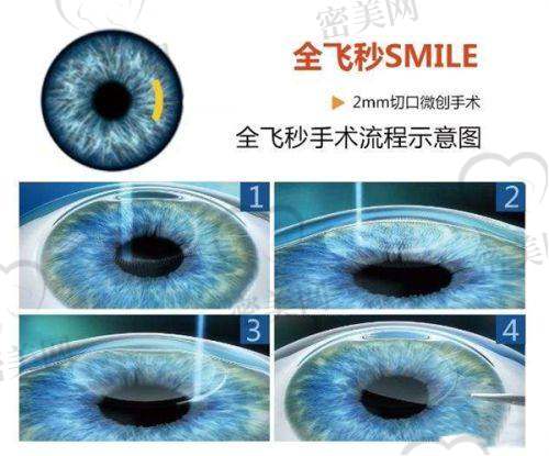 佛山市第一人民医院眼科医生团队介绍：专精背景强，专病专治