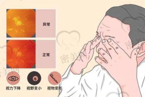 哈尔滨医 科 大学眼科医学校是正规的吗？