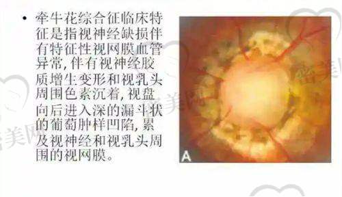 张家界市人民医院近视术后配镜与护理费用说明