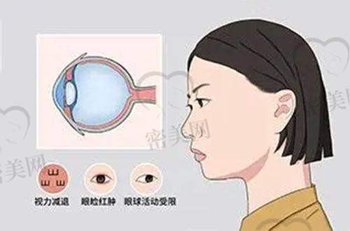 哈医 大一院眼科价格表：