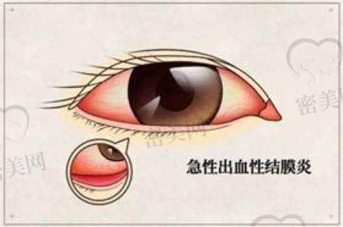 哈尔滨医 科 大学眼科医学校口碑怎么样？
