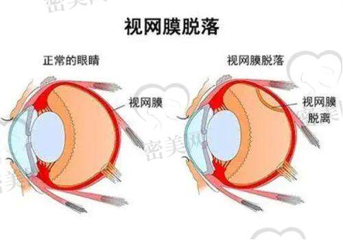 哈尔滨医 科 大学附属第一医院眼科口碑怎么样？