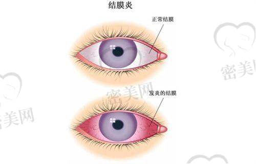 佛山市第一人民医院眼科怎么样？医生技术实力强，眼病治疗项目齐全