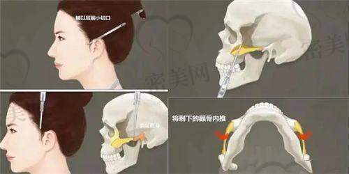 李瑞医生口碑怎么样？