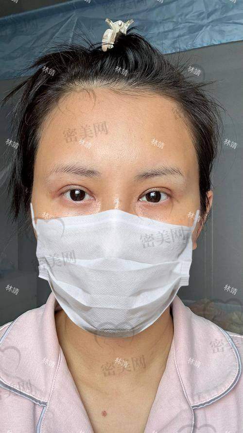 西宁娇健医美整形门诊部——马建勋医生的疑难攻克