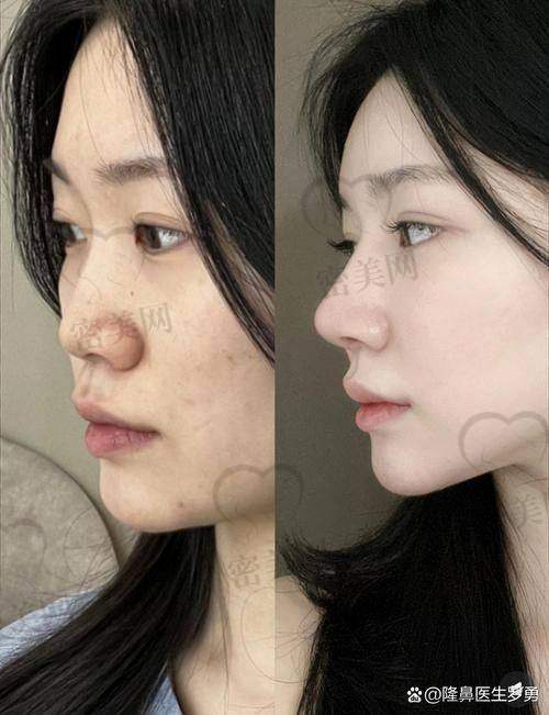 上海艺星整形：实力雄厚的美鼻殿堂