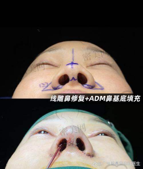 赵丹医生的神奇操作，手术进行时