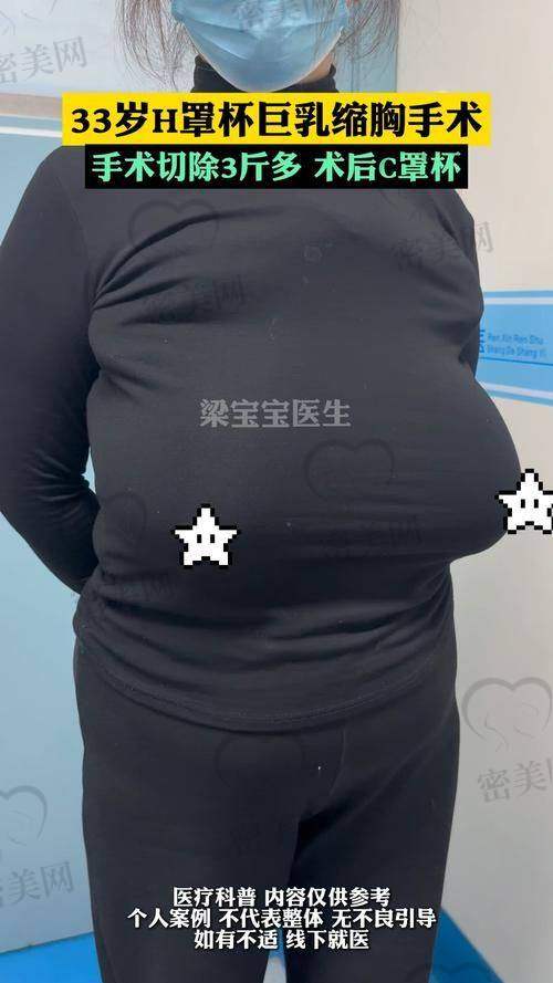 广州中家医家庭医生整形医院：专注乳房整形，40年老骨干医生坐镇