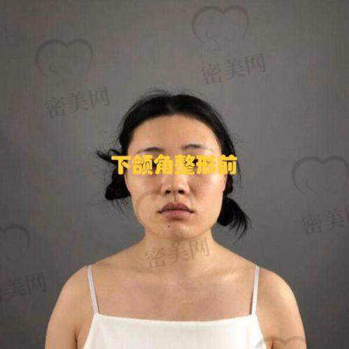 术后修复，见证奇迹时刻