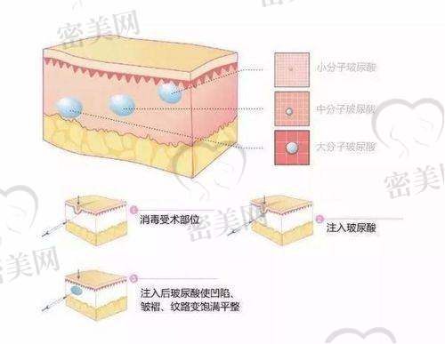 成都金牛纯曦医疗美容馒化修复用的设备技术靠谱吗？进口多功能机器一应俱全
