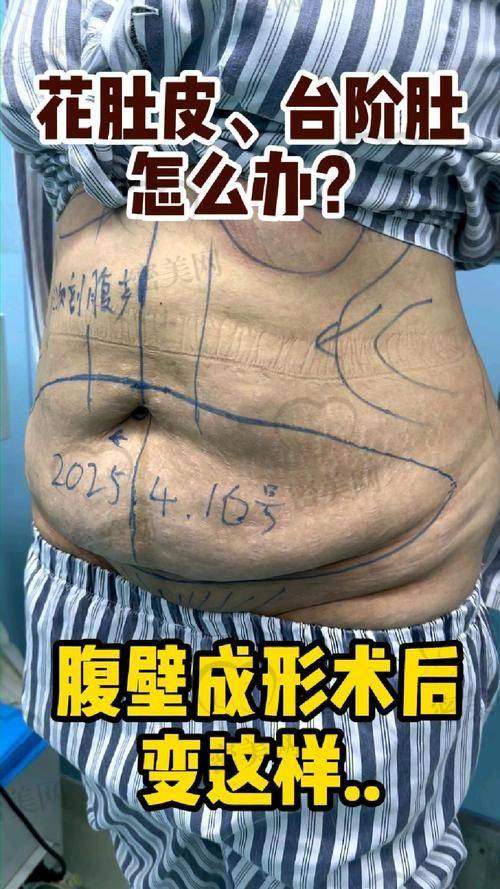 北京樱桃医疗美容诊所——注重形体线条的整形所