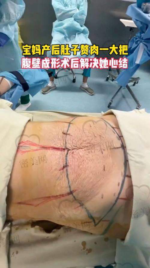 北京十大热门腹壁成形术医疗机构一览