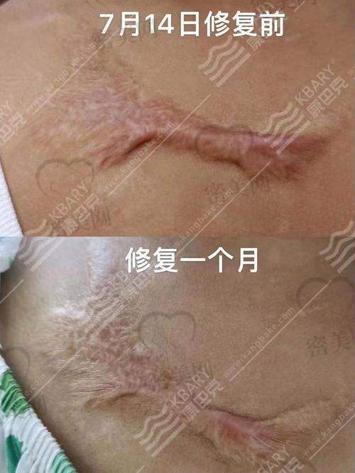 技术背后看功底，池凯医生的学术背景与临床经验