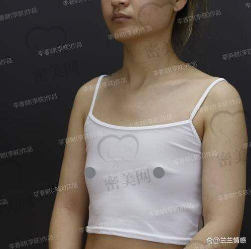 注射玻尿酸丰胸全过程揭秘