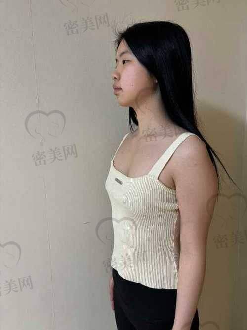 成效能维持多久？