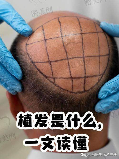 谢宝山医生怎么预约挂号？