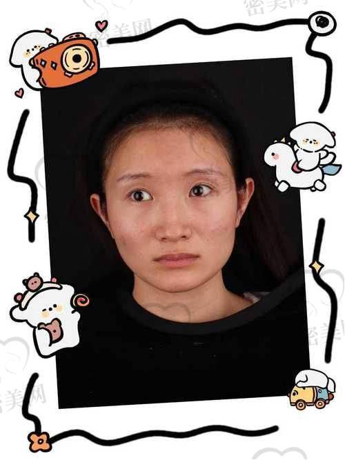 沈阳友谊韩式整形医院：轻轮廓韩式风格打造