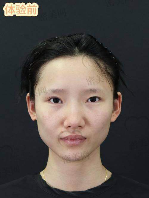 沈阳北方正颌整形医院：专注颌面功能与美学