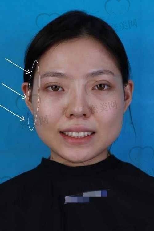 沈阳杏林整形外科医院：高难度轮廓手术开拓者