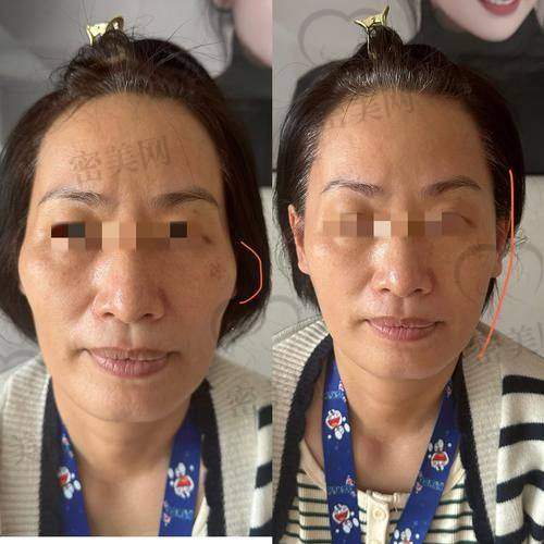 沈阳艾尔医疗美容：术前评估专精，术后修复快