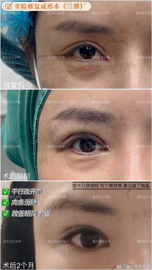 北京晶美医疗美容魏志香：内眼角修复的“价格精灵”