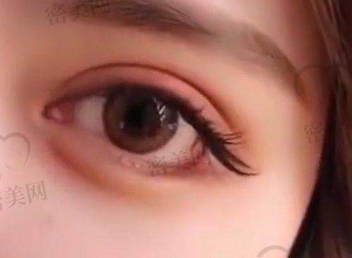 瞿健医生的口碑怎么样