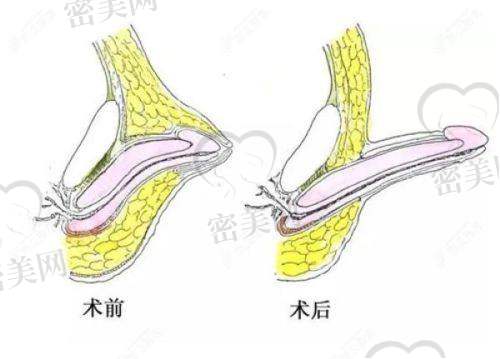 许丽琳医生擅长项目：