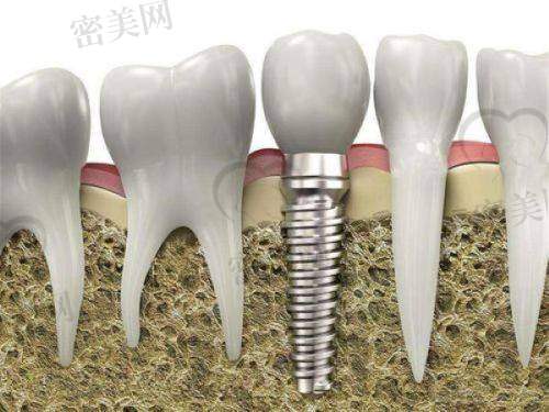 上海侯晓辉口腔诊所医生名单：