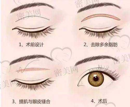 侯浪医生口碑怎么样？