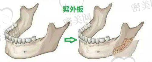 周秀峰医生技术特点：