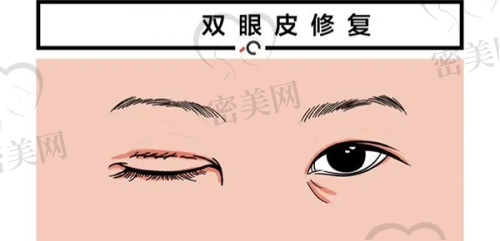 徐凌艳医生怎么预约挂号？