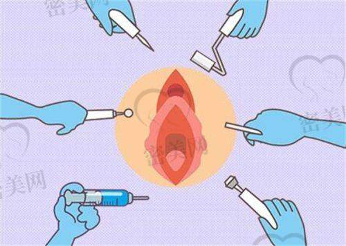 刘剑医生口碑怎么样？